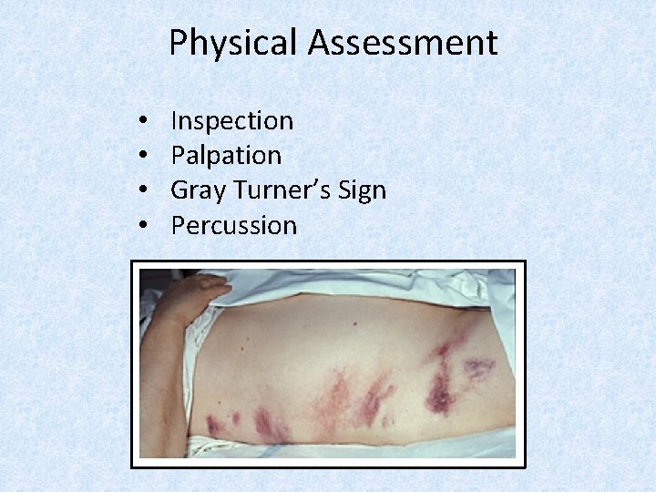 Physical Assessment • • Inspection Palpation Gray Turner’s Sign Percussion 