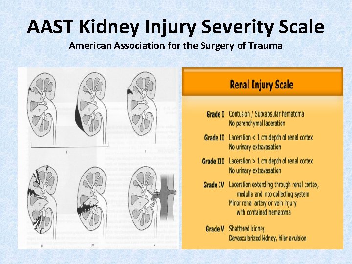 AAST Kidney Injury Severity Scale American Association for the Surgery of Trauma 