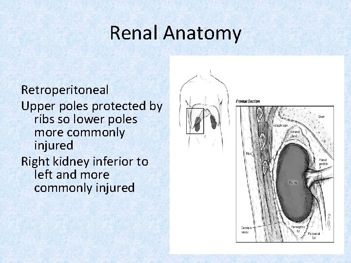 Renal Anatomy Retroperitoneal Upper poles protected by ribs so lower poles more commonly injured