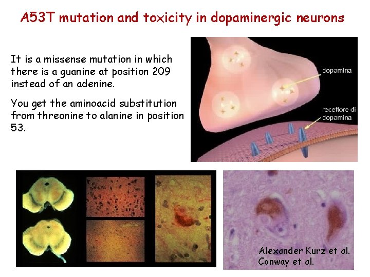 A 53 T mutation and toxicity in dopaminergic neurons It is a missense mutation