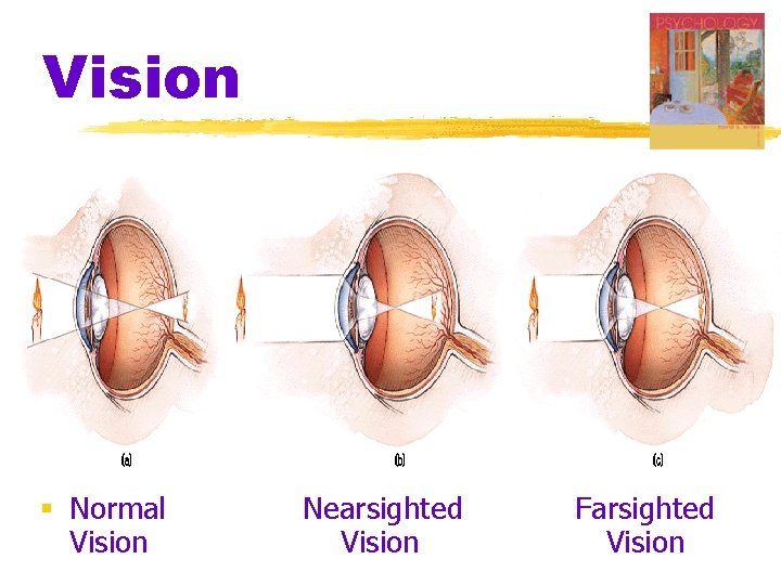 Vision § Normal Vision Nearsighted Vision Farsighted Vision Vision § Normal Vision Nearsighted Vision Farsighted Vision