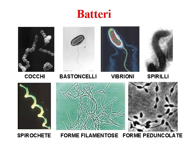 Batteri COCCHI SPIROCHETE BASTONCELLI VIBRIONI SPIRILLI 1 FORME FILAMENTOSE FORME PEDUNCOLATE 