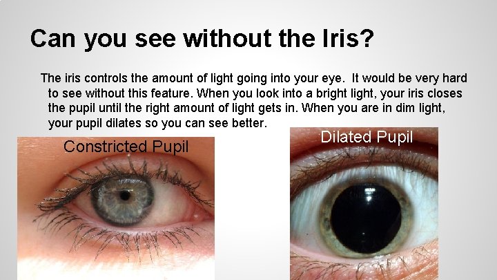 Can you see without the Iris? The iris controls the amount of light going