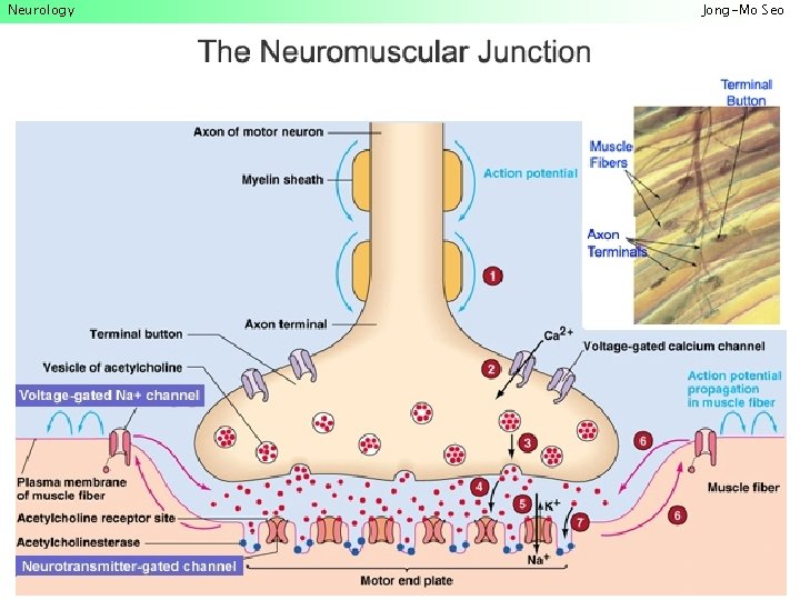 Neurology Jong-Mo Seo 