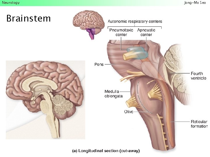 Neurology Brainstem Jong-Mo Seo 