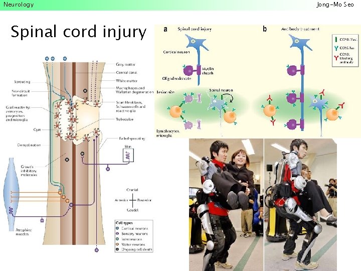 Neurology Spinal cord injury Jong-Mo Seo 