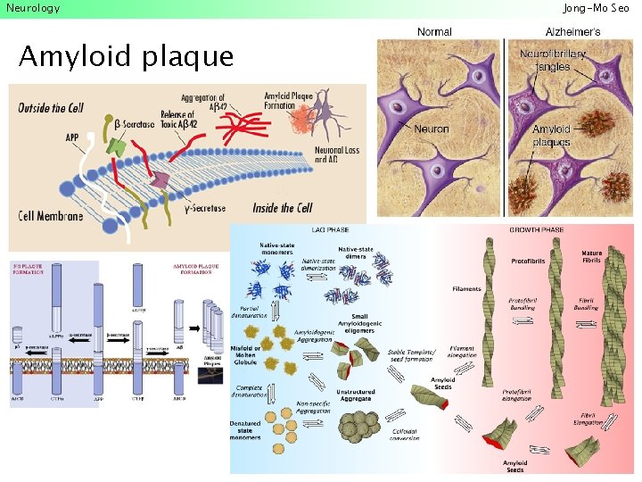 Neurology Amyloid plaque Jong-Mo Seo 