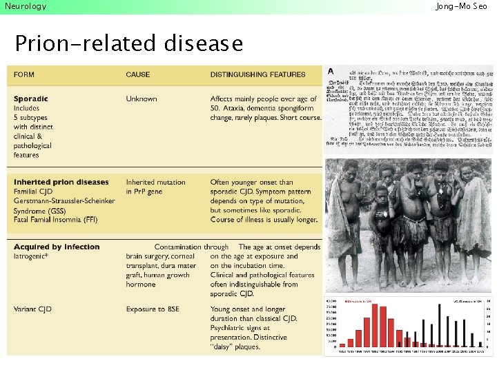 Neurology Prion-related disease Jong-Mo Seo 