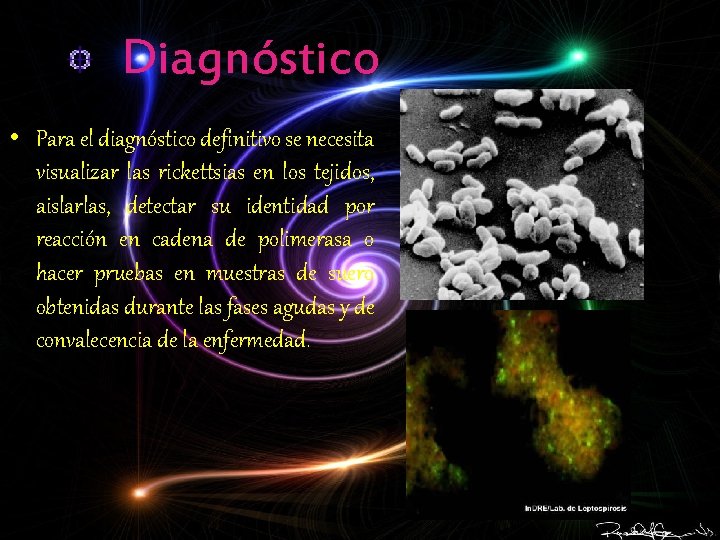 Diagnóstico • Para el diagnóstico definitivo se necesita visualizar las rickettsias en los tejidos,