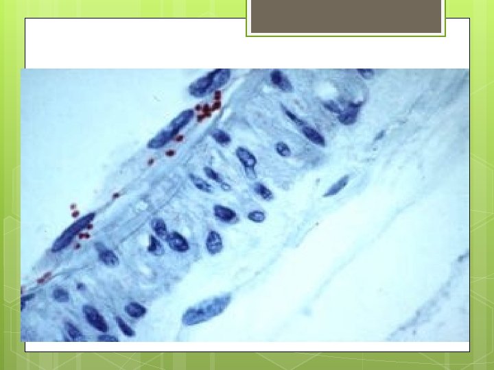 ¿QUE SON LAS RICKETTSIAS? Rickettsia es un género de bacterias (colectivamente denominadas rickettsias) que