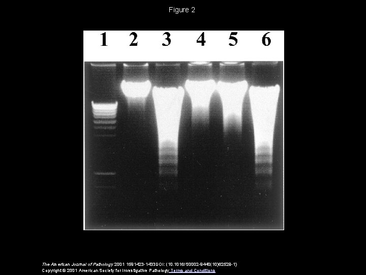 Figure 2 The American Journal of Pathology 2001 1591423 -1433 DOI: (10. 1016/S 0002