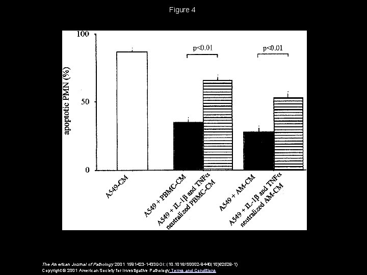 Figure 4 The American Journal of Pathology 2001 1591423 -1433 DOI: (10. 1016/S 0002