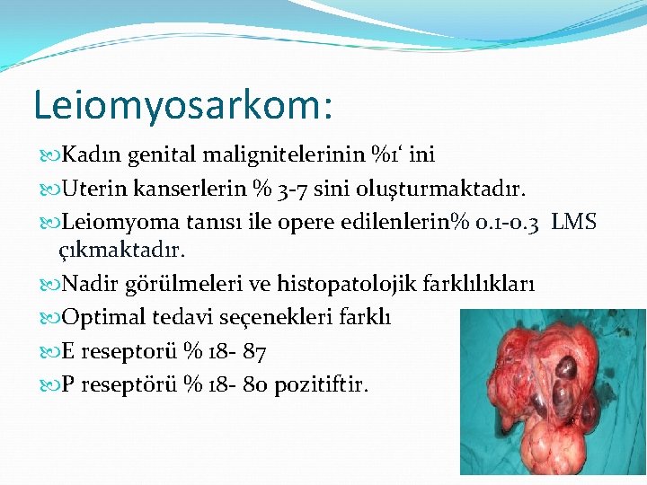 Leiomyosarkom: Kadın genital malignitelerinin %1‘ ini Uterin kanserlerin % 3 -7 sini oluşturmaktadır. Leiomyoma