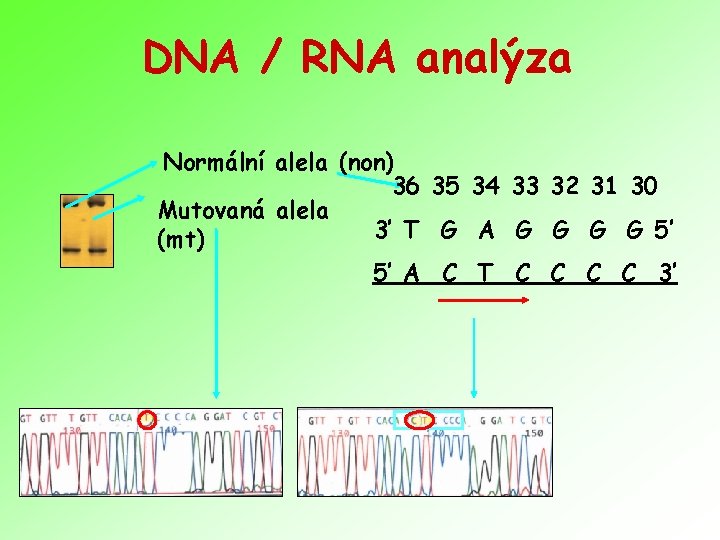 DNA / RNA analýza Normální alela (non) 36 35 34 33 32 31 30