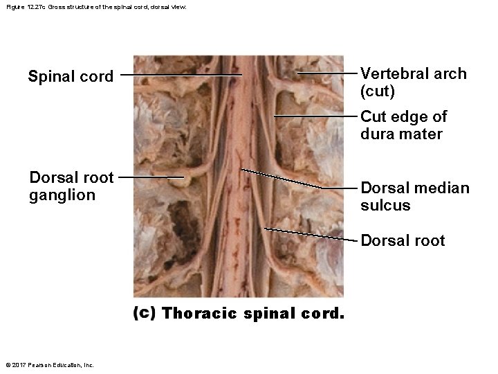 Figure 12. 27 c Gross structure of the spinal cord, dorsal view. Vertebral arch