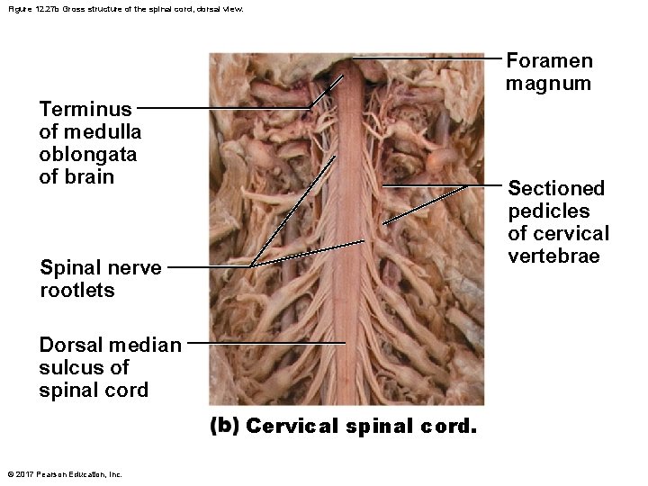 Figure 12. 27 b Gross structure of the spinal cord, dorsal view. Foramen magnum