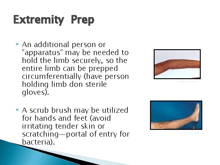 Extremity Prep An additional person or “apparatus” may be needed to hold the limb Extremity Prep An additional person or “apparatus” may be needed to hold the limb