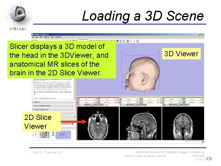 Loading a 3 D Scene Slicer displays a 3 D model of the head Loading a 3 D Scene Slicer displays a 3 D model of the head