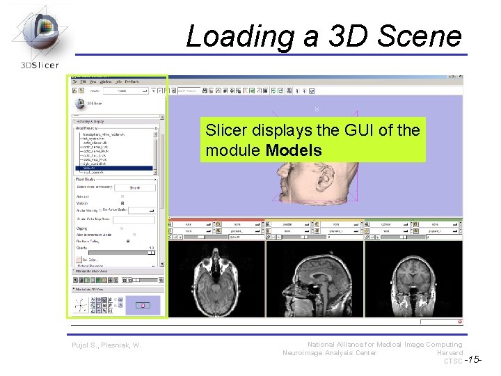 Loading a 3 D Scene Slicer displays the GUI of the module Models Pujol Loading a 3 D Scene Slicer displays the GUI of the module Models Pujol