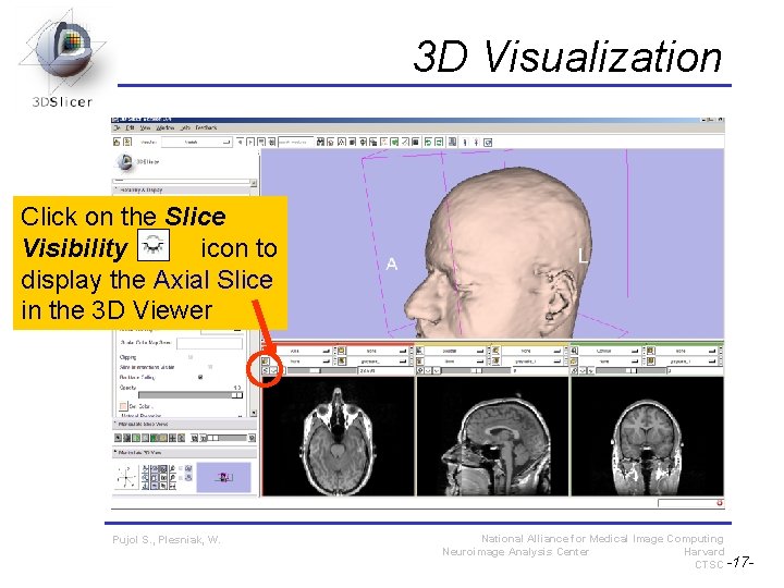 3 D Visualization Click on the Slice Visibility icon to display the Axial Slice 3 D Visualization Click on the Slice Visibility icon to display the Axial Slice