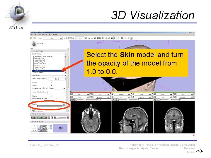3 D Visualization Select the Skin model and turn the opacity of the model 3 D Visualization Select the Skin model and turn the opacity of the model