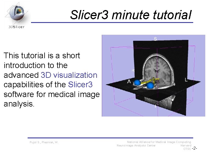 Slicer 3 minute tutorial This tutorial is a short introduction to the advanced 3 Slicer 3 minute tutorial This tutorial is a short introduction to the advanced 3