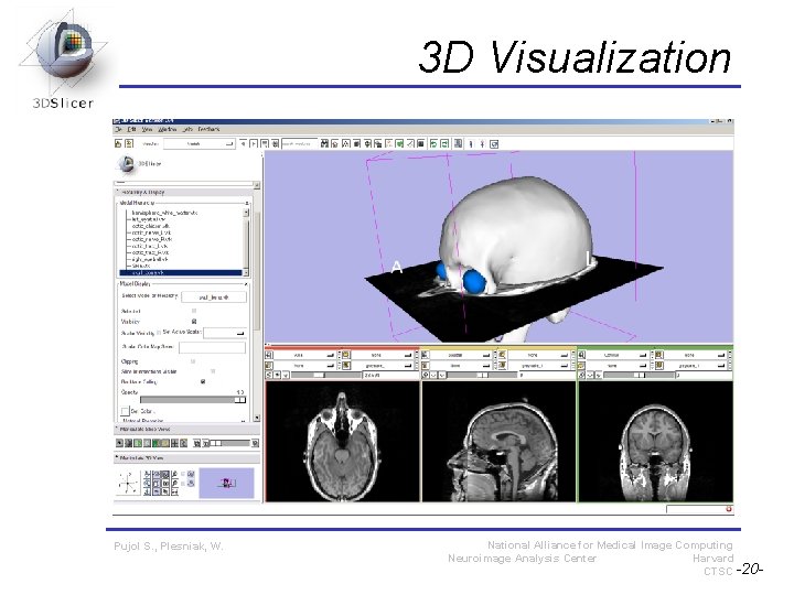 3 D Visualization Pujol S. , Plesniak, W. National Alliance for Medical Image Computing 3 D Visualization Pujol S. , Plesniak, W. National Alliance for Medical Image Computing