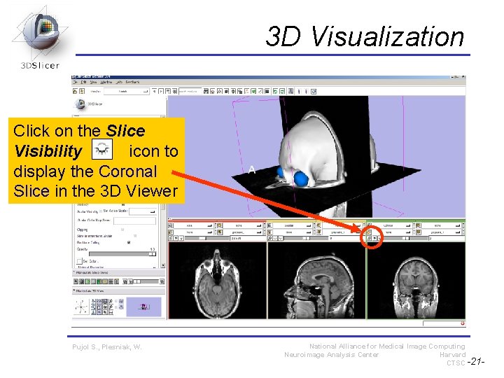 3 D Visualization Click on the Slice Visibility icon to display the Coronal Slice 3 D Visualization Click on the Slice Visibility icon to display the Coronal Slice
