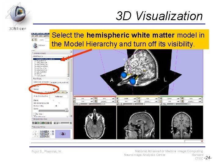 3 D Visualization Select the hemispheric white matter model in the Model Hierarchy and 3 D Visualization Select the hemispheric white matter model in the Model Hierarchy and