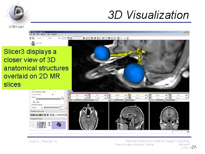 3 D Visualization Slicer 3 displays a closer view of 3 D anatomical structures 3 D Visualization Slicer 3 displays a closer view of 3 D anatomical structures
