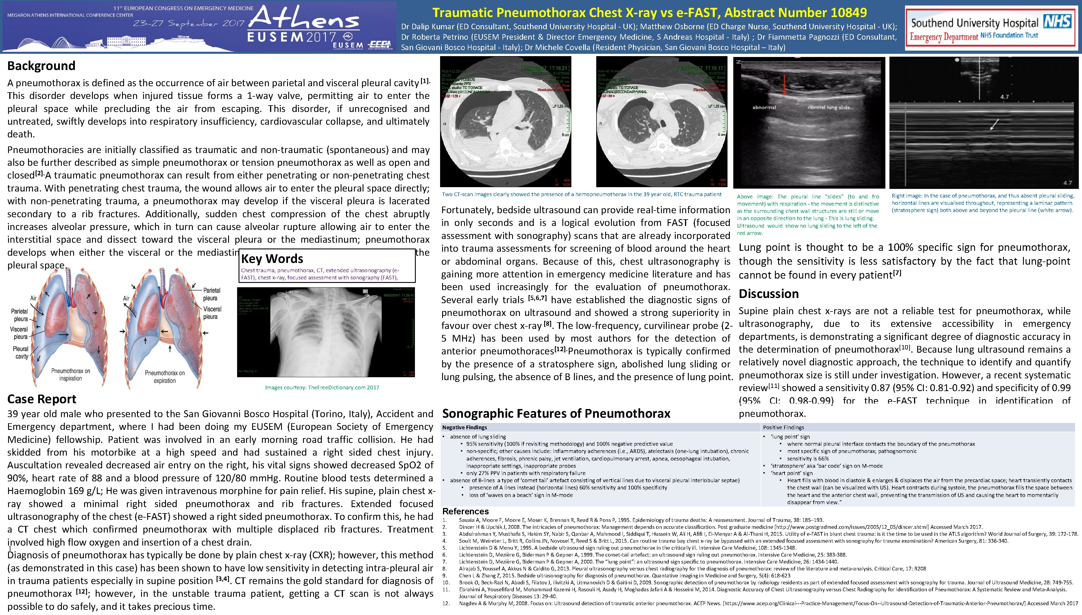 Traumatic Pneumothorax Chest X-ray vs e-FAST, Abstract Number 10849 Dr Dalip Kumar (ED Consultant,