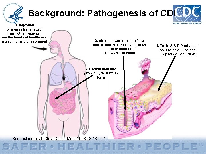 Background: Pathogenesis of CDI 1. Ingestion of spores transmitted from other patients via the