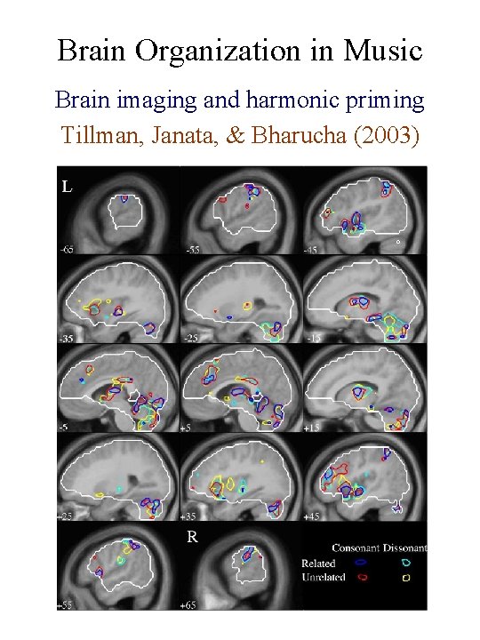 Brain Organization in Music Brain imaging and harmonic priming Tillman, Janata, & Bharucha (2003)