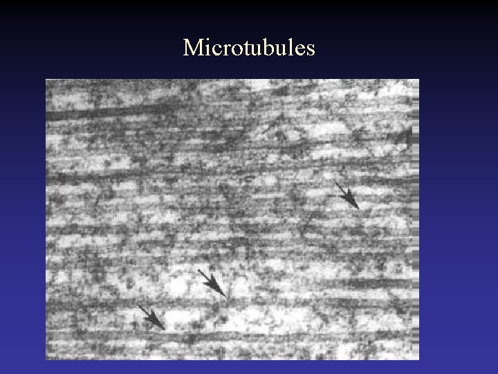 Microtubules 