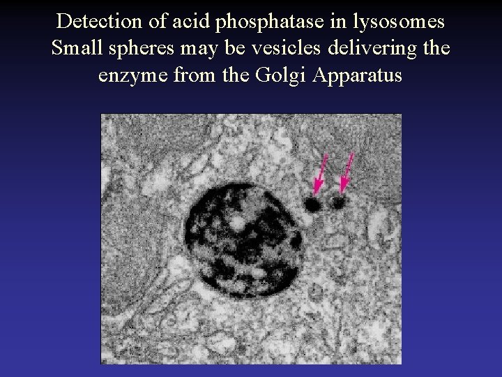 Detection of acid phosphatase in lysosomes Small spheres may be vesicles delivering the enzyme