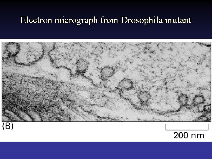 Electron micrograph from Drosophila mutant 