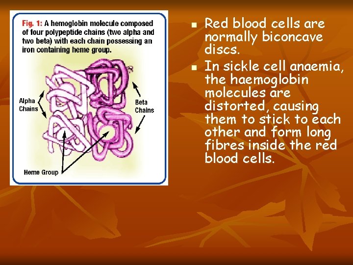 n n Red blood cells are normally biconcave discs. In sickle cell anaemia, the