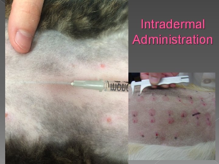 Intradermal Administration 