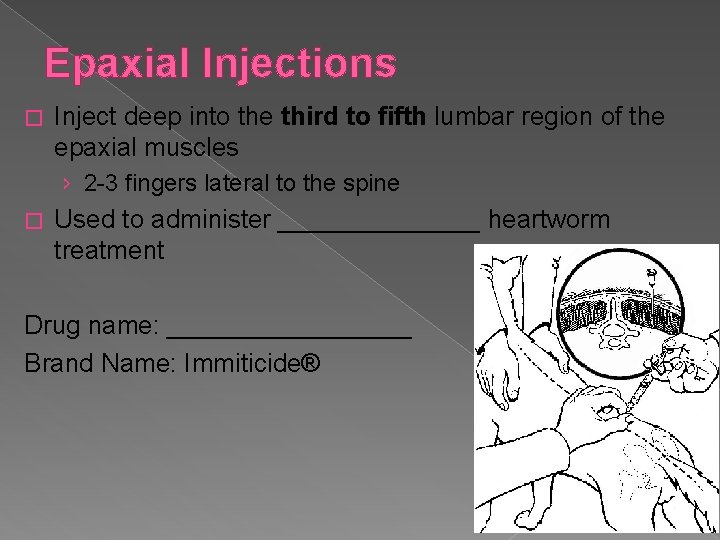 Epaxial Injections � Inject deep into the third to fifth lumbar region of the