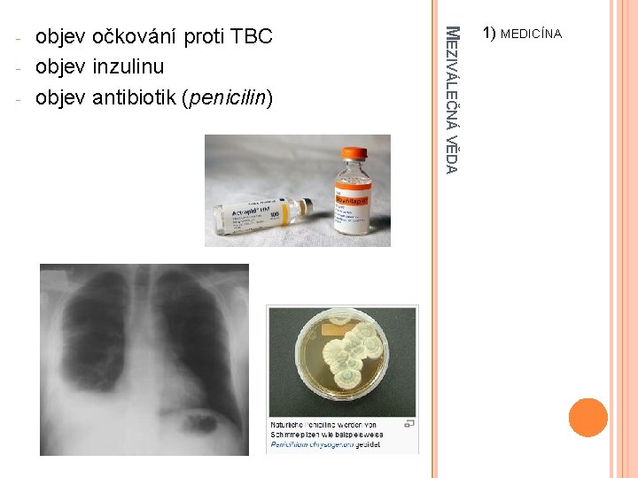 - objev očkování proti TBC objev inzulinu objev antibiotik (penicilin) MEZIVÁLEČNÁ VĚDA - 1)