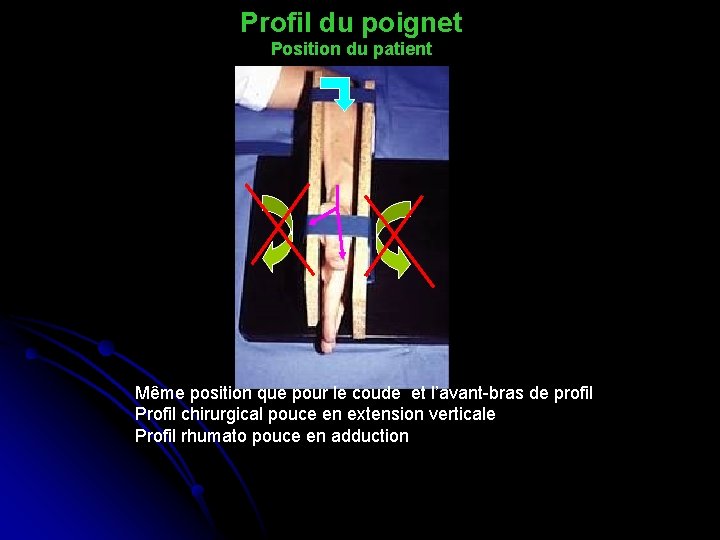 Profil du poignet Position du patient Même position que pour le coude et l’avant-bras