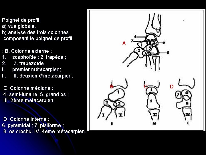 Poignet de profil. a) vue globale. b) analyse des trois colonnes composant le poignet