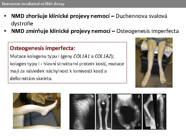 Nonsense mediated m. RNA decay • NMD zhoršuje klinické projevy nemocí – Duchennova svalová