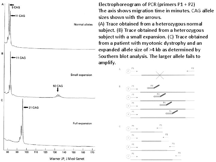 Electrophoreogram of PCR (primers P 1 + P 2) The axis shows migration time