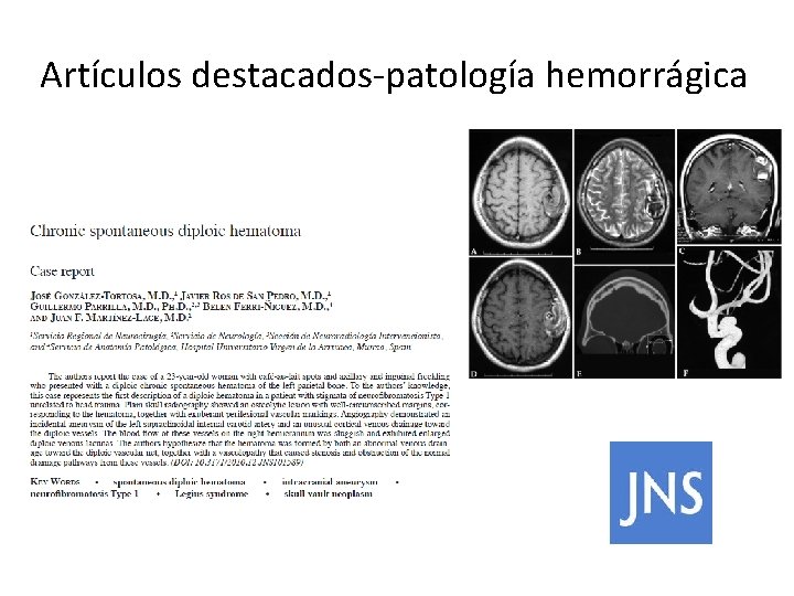 Artículos destacados-patología hemorrágica 