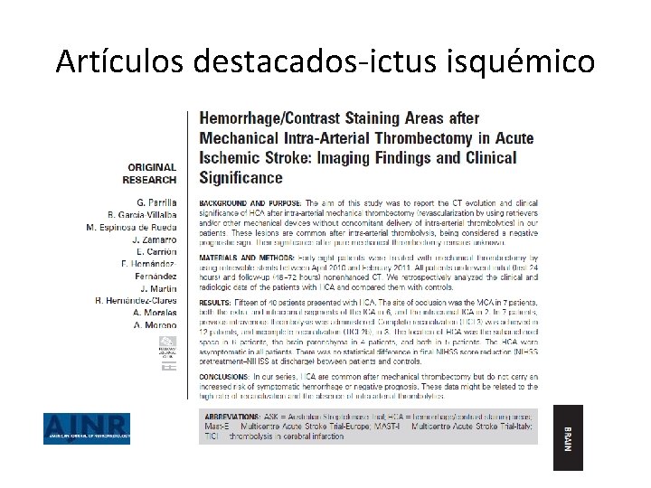 Artículos destacados-ictus isquémico 