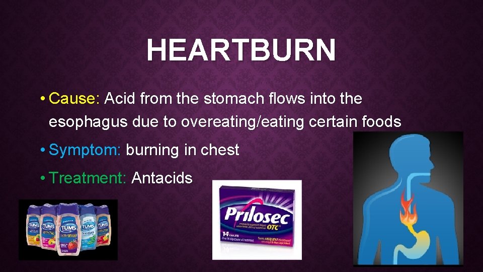 HEARTBURN • Cause: Acid from the stomach flows into the esophagus due to overeating/eating