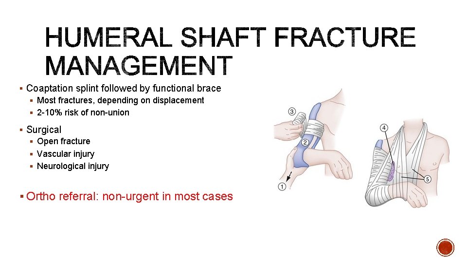 § Coaptation splint followed by functional brace § Most fractures, depending on displacement §