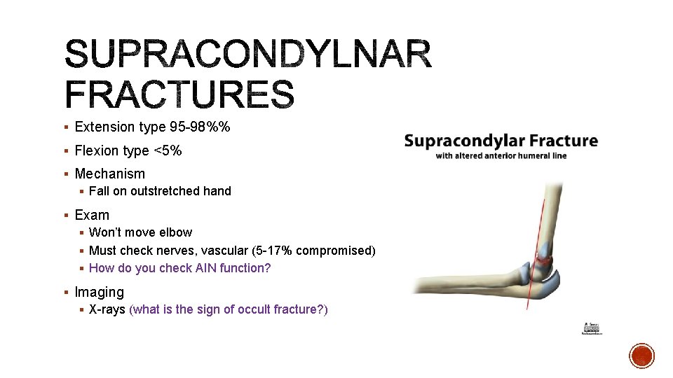 § Extension type 95 -98%% § Flexion type <5% § Mechanism § Fall on