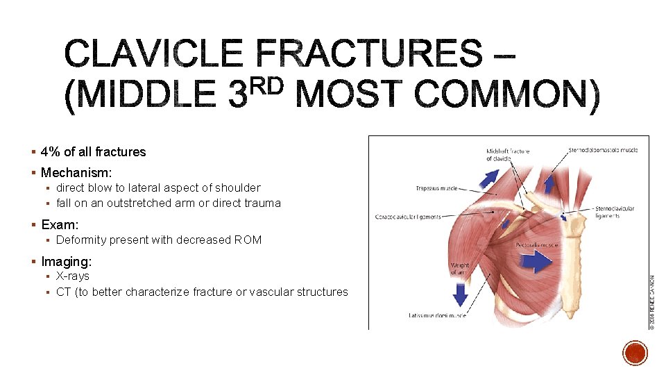 § 4% of all fractures § Mechanism: § direct blow to lateral aspect of